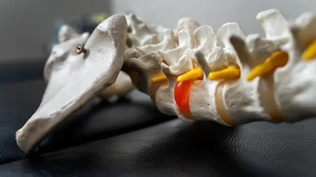 Anatomisches Wirbelsäulenmodell mit farblich markierten Bandscheiben als Bezug zum Börsengang des Medizintechnikunternehmens Carlsmed