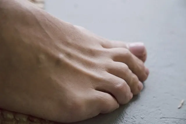 Nahaufnahme eines nackten Fußes mit sichtbaren Zehen auf grauem Untergrund, ohne erkennbaren Bezug zum Börsengang von Turn Therapeutics.