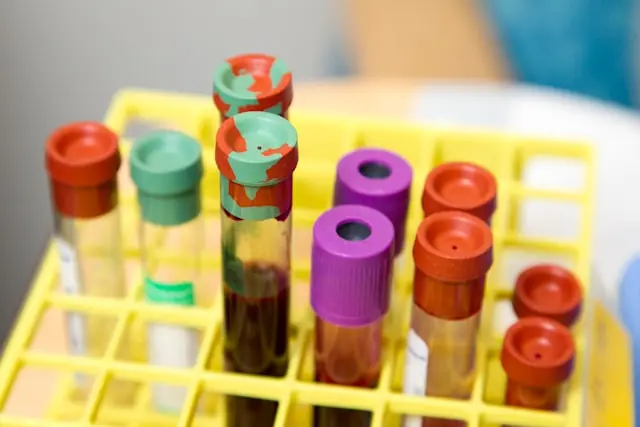 Mehrere Blutentnahmeröhrchen in einem gelben Laborgestell stehen für die diagnostische Expertise von Caris Life Sciences vor dem Börsengang.